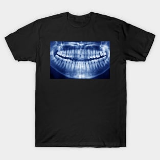 You See Right Through Me aka X-ray Smile T-Shirt